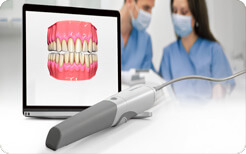 3D-сканирование