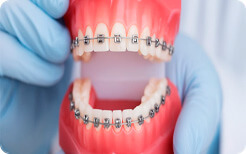 Ортодонтия